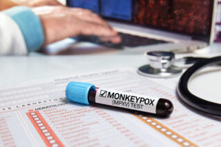 Monkeypox in 2024: What You Need to Know