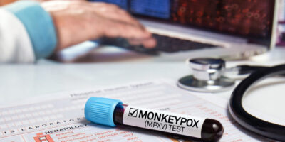 Monkeypox in 2024: What You Need to Know