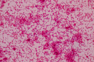 Beyond Blood Supply: Tumor Angiogenesis and its Role in Cancer Progression