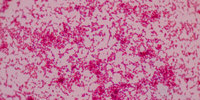 Beyond Blood Supply: Tumor Angiogenesis and its Role in Cancer Progression