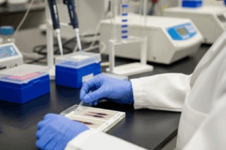 What is The Role of Polyclonal Western Blot in Fatty Liver Disease Research?